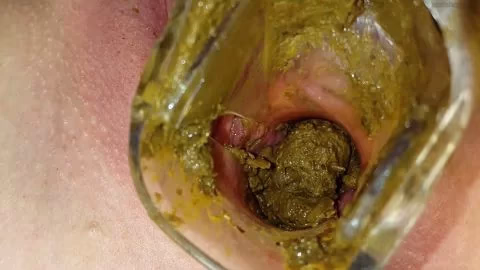 Inside AnnaCoprofield's dirty schoolgirls shit filled pussy part 2